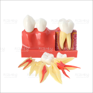 치아형태모형4배크기/치아 형태설명/3단계 치아분리/치아모형/조립모형